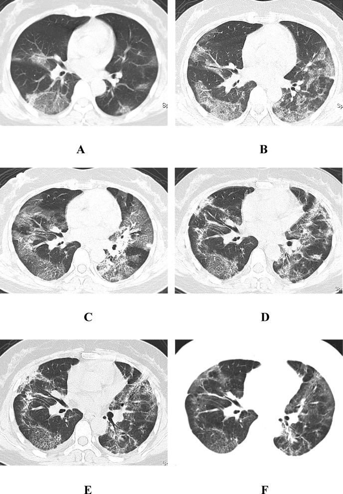 Fig. 4