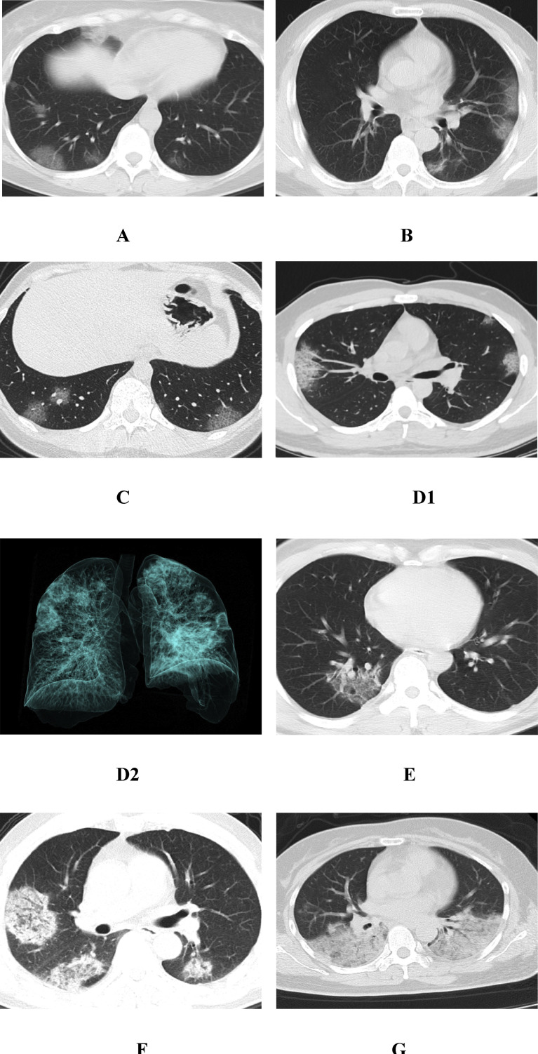 Fig. 1