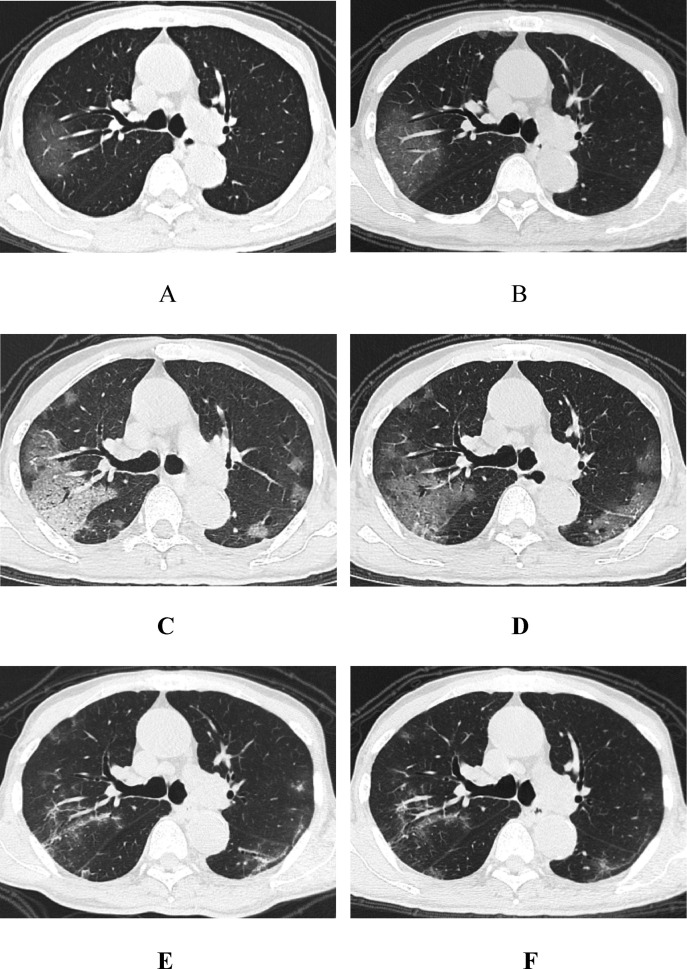 Fig. 2