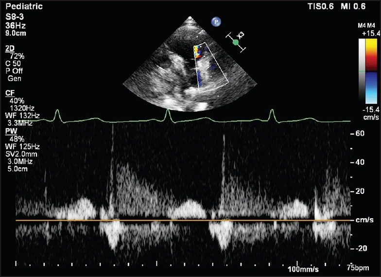 Figure 5