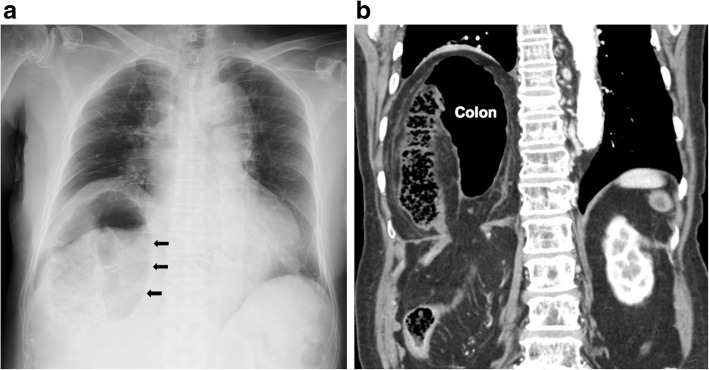 Fig. 5