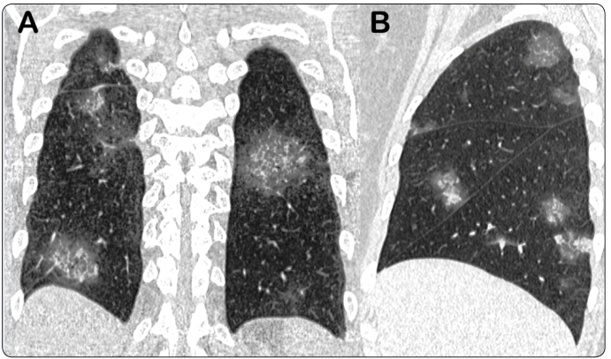 FIGURE 1: