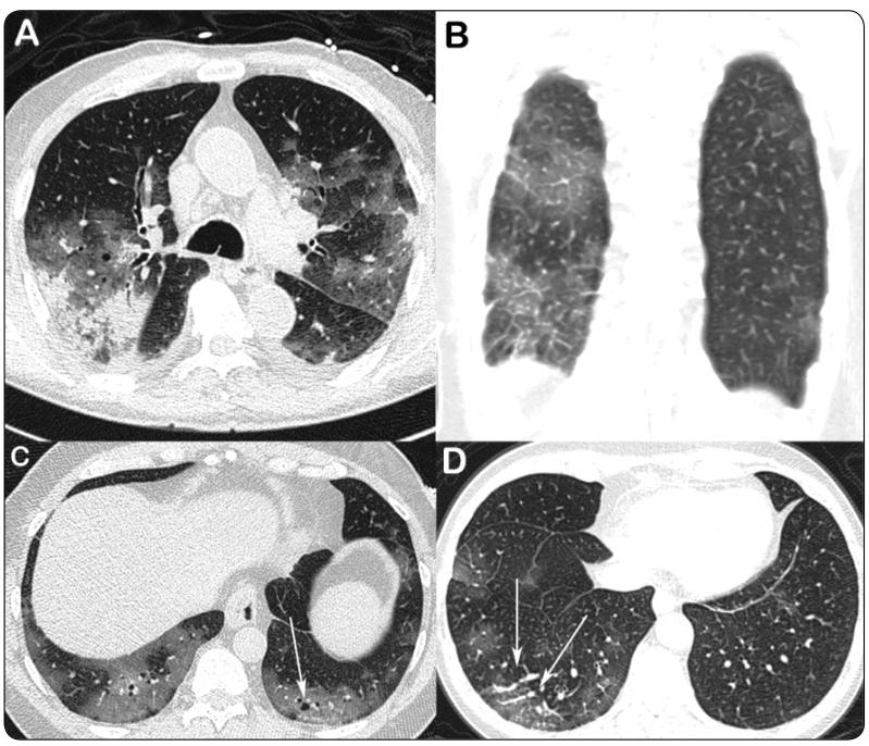 FIGURE 2: