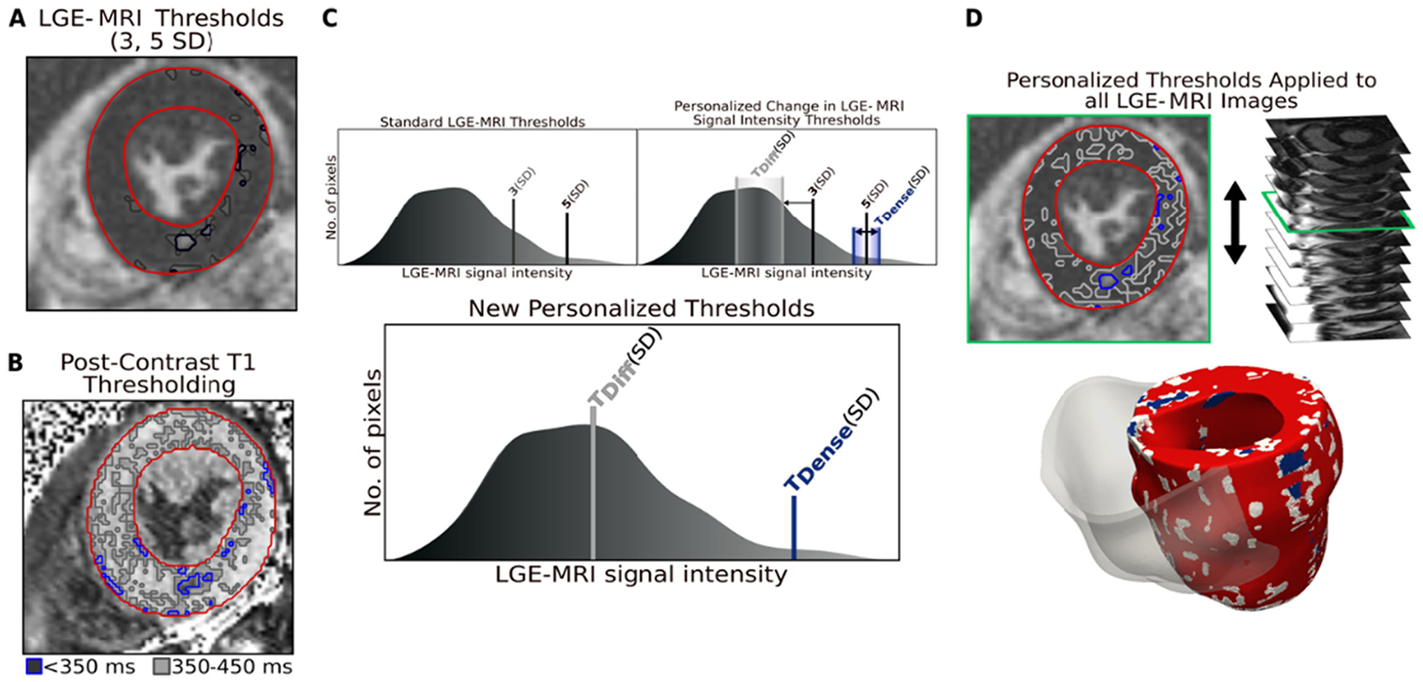 Arrhythmia in hypertrophic cardiomyopathy: Risk prediction using ...