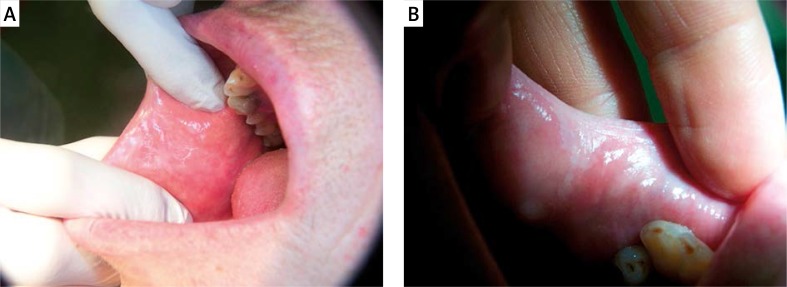 Figure 1A–B