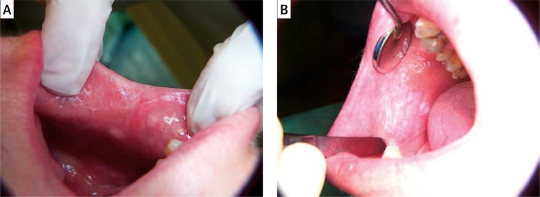 Figure 2A–B