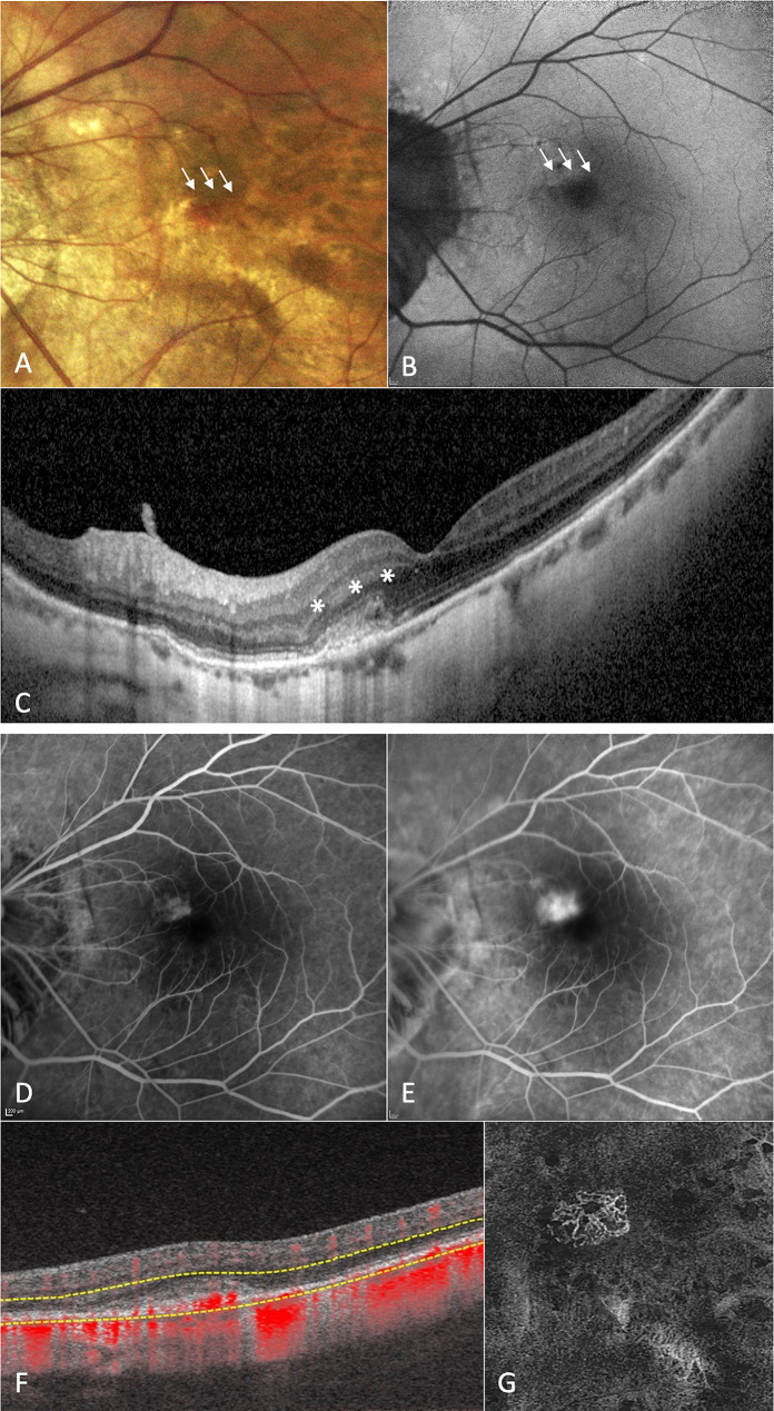 Fig. 1