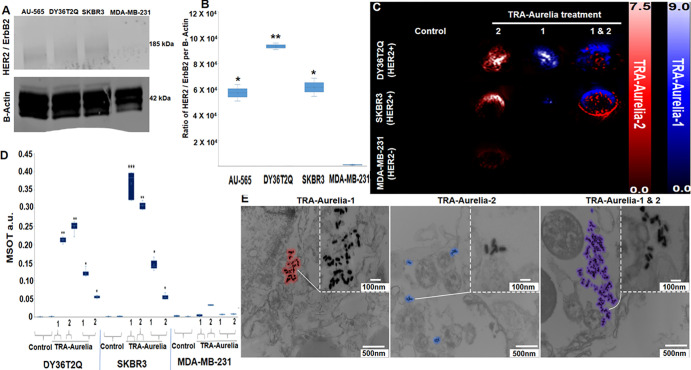 (A, B) Western blot analysis of human epidermal growth factor receptor 2 (HER2; also known as ERBB2)–positive expression profile in HER2-positive DY36T2Q (93 206 au, P = .002), SKBR3 (61 439 au, P = .019), AU-565 (57 100 au, P = .019), and HER2-negative MDA-MB-231 (5174 au) breast cancer cells. (C) DY36T2Q, SKBR3, and MDA-MB-231 cells after treatment with trastuzumab (TRA)-Aurelia-1 and TRA-Aurelia-2 were imaged with multispectral optoacoustic tomography (MSOT). Image postprocessing represents TRA-Aurelia-1 in blue and TRA-Aurelia-2 in red color. (D) Simultaneous MSOT-based detection of TRA-Aurelia-1 and TRA-Aurelia-2 in HER2-positive breast cancer cell lines DY36T2Q (TRA-Aurelia-1, P = .001; TRA-Aurelia-2, P = .001; combined TRA-Aurelia-1, P < .001; combined TRA-Aurelia-2, P = .003) and SKBR3 (TRA-Aurelia-1, P = .006; TRA-Aurelia-2, P = .002; combined TRA-Aurelia-1, P < .001; combined TRA-Aurelia-2, P < .001), in comparison with HER2-negative MDA-MB-231 cells. (E) Transmission electron micrograph demonstrates DY36T2Q cellular uptake of TRA-Aurelia-1 (outlined in blue), TRA-Aurelia-2 (outlined in red), and the combination of both (outlined in purple). TRA-Aurelia-1 and TRA-Aurelia-2 are distributed in the cytoplasm, vesicles, and nucleus. Individual TRA-Aurelia-1 and TRA-Aurelia-2 are shown in the inset. Transmission electron microscopy images of HER2-negative MDA-MB-231 cells did not show any uptake. *** = P < .001, ** = P < .01, and *= P < .05, a.u. = arbitrary units.