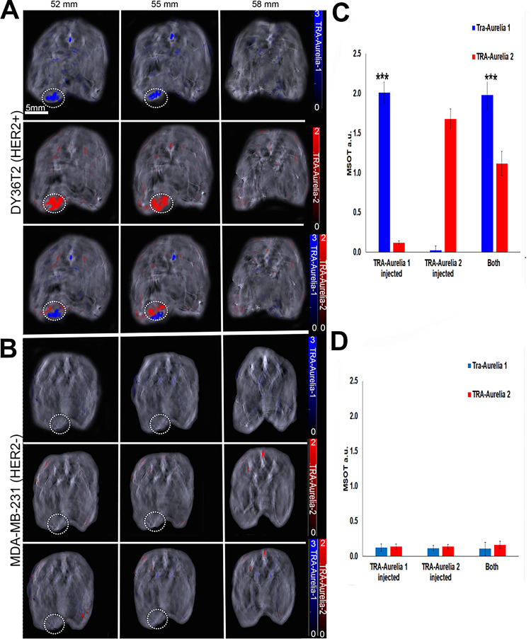 Simultaneous detection of the trastuzumab (TRA)-Aurelia-1 and Aurelia-2 gold nanorod (GNR) on images of athymic mice (n = 5; survival rate of 100%) bearing an orthotopically implanted mammary fat pad tumor (DY36T2Q or MDA‐MB‐231) at the predetermined time point of 6 hours after the intravenous injection of TRA-Aurelia-1 GNR, TRA-Aurelia-2 GNR, or in combination. (A, B) DY36T2Q breast tumor–bearing mice had high TRA-Aurelia-1 (blue color bar; 14.8-fold increase, P < .0001) and TRA-Aurelia-2 (red color bar; 20.8-fold increase, P < .0001) GNR uptake in the tumor in comparison with MDA-MB-231 tumor–bearing mice. (C, D) Bar graphs of multispectral optoacoustic tomography (MSOT) signal uptake in each cell line demonstrate that MDA‐MB‐231 breast tumor–bearing mice had negligible amounts of both TRA-Aurelia-1 and TRA-Aurelia-2 GNRs. *** = P < .001, a.u. = arbitrary units, HER2+ = human epidermal growth factor receptor 2–positive cells, HER2- = human epidermal growth factor receptor 2–negative cells.