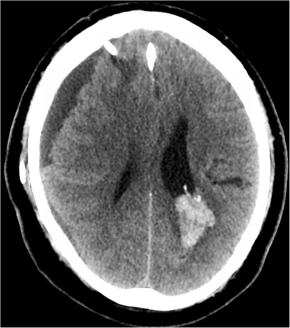 Fig. 3
