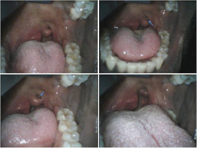 Fig. 3