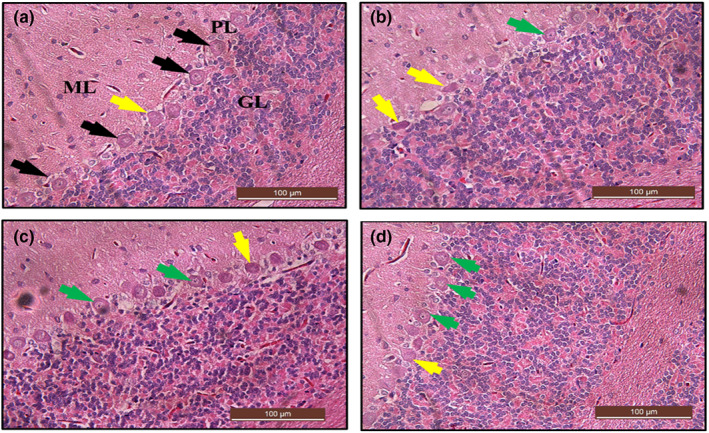 FIGURE 18