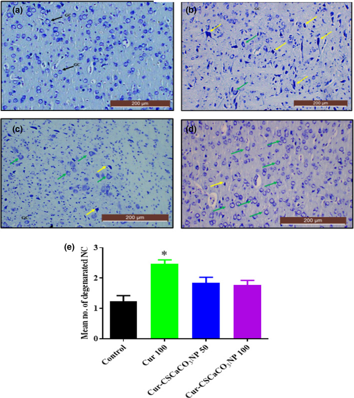 FIGURE 15