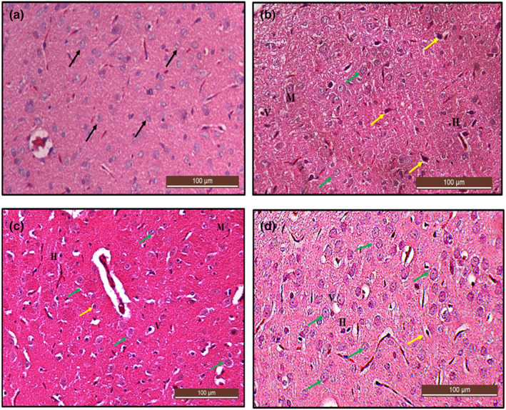 FIGURE 14