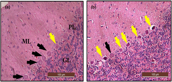 FIGURE 16