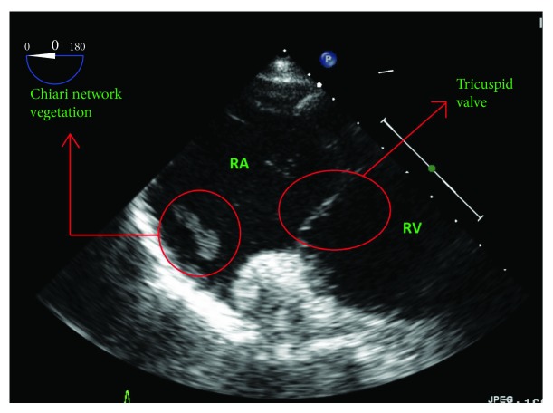 Figure 4