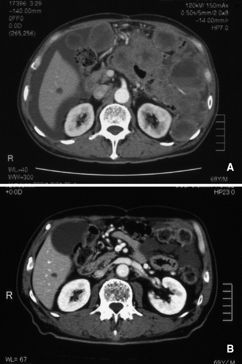 Fig. 1