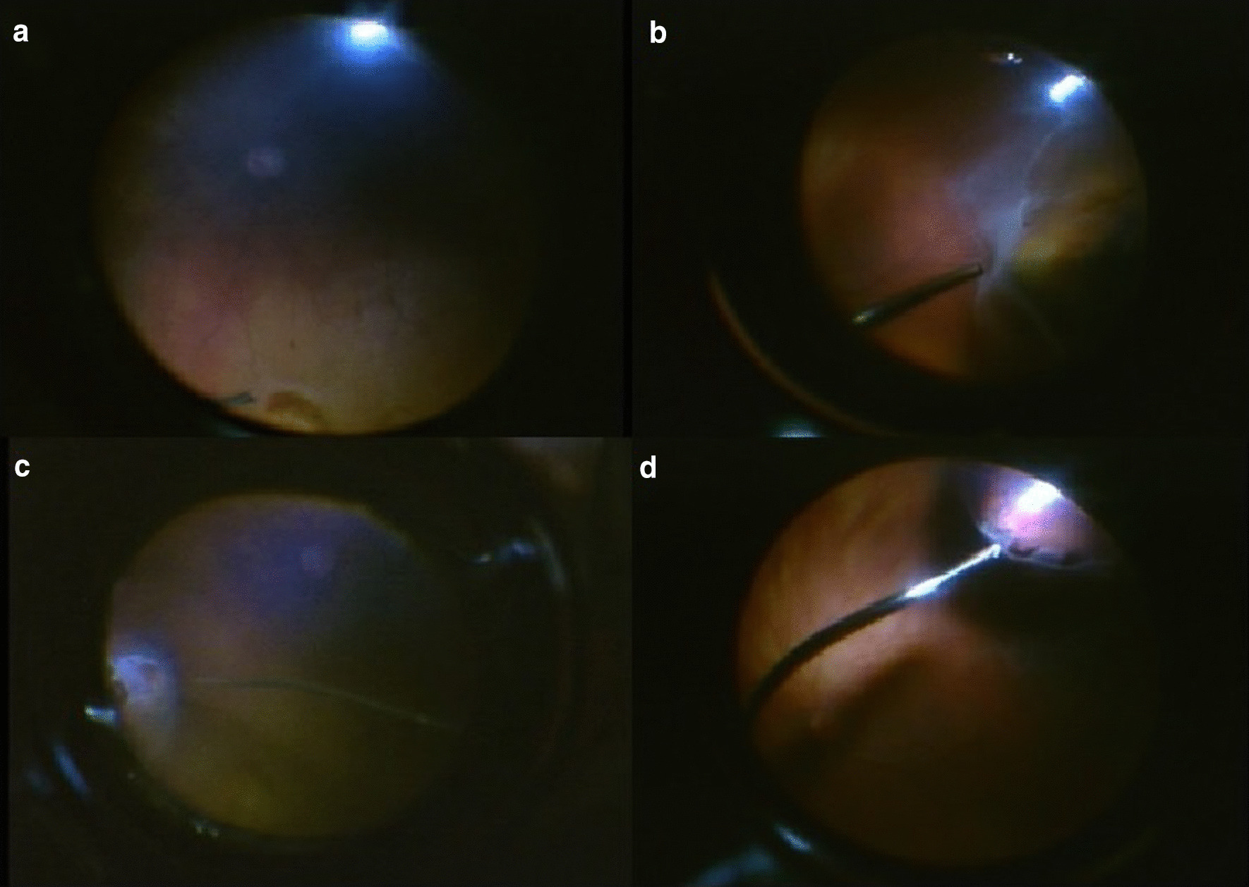 Fig. 2