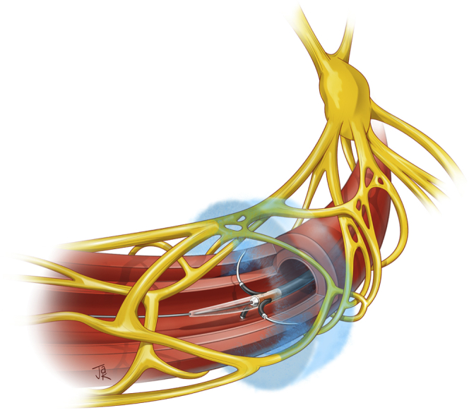 Figure 2