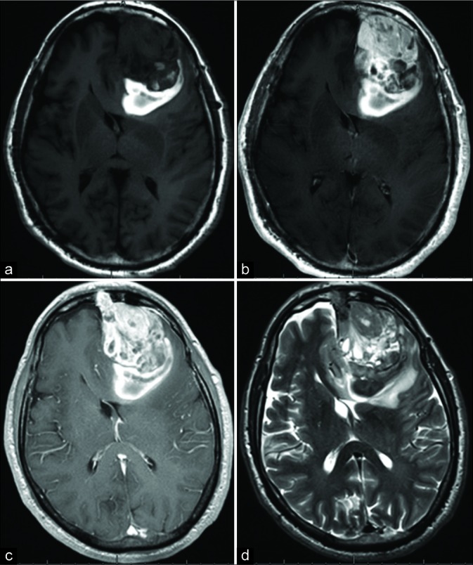 Figure 2: