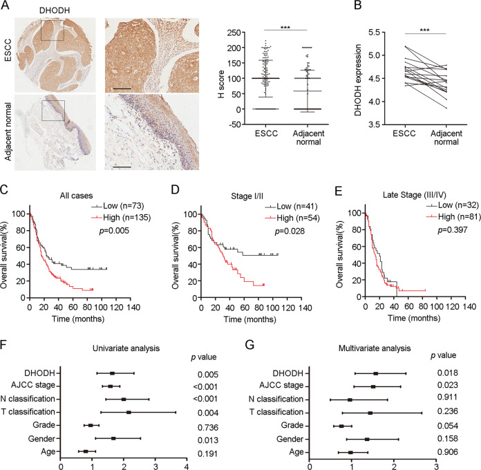 Elevated DHODH expression promotes cell proliferation via stabilizing β ...