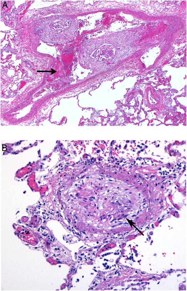 Figure 4