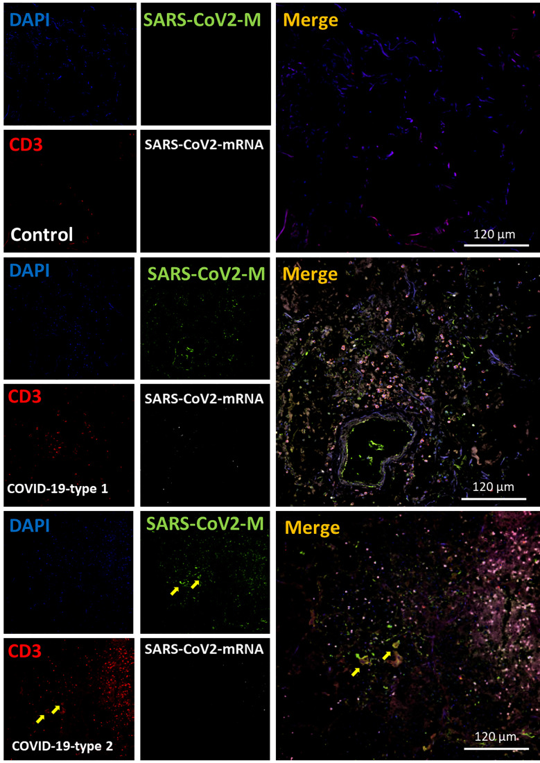 Figure 6