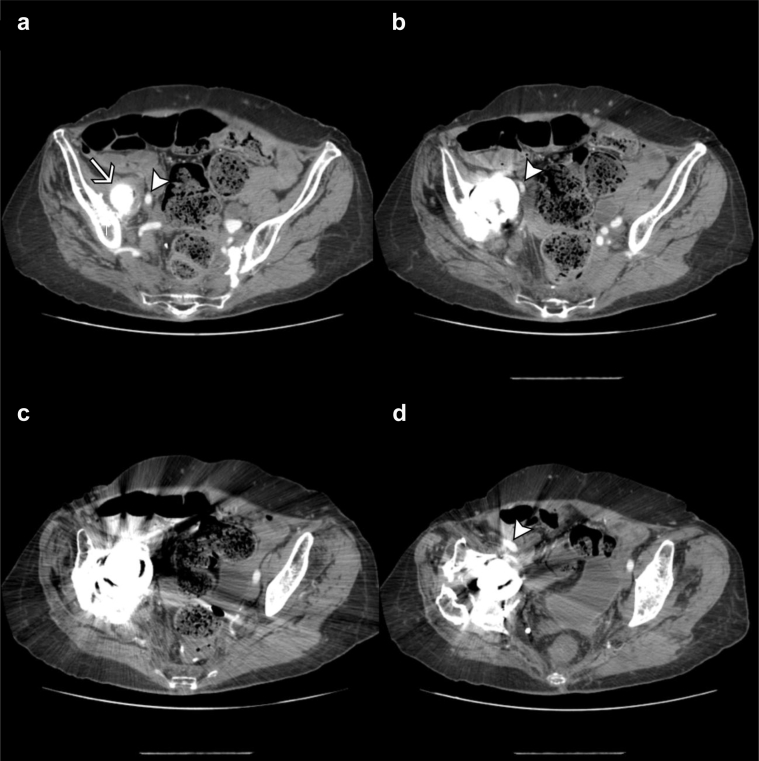 Figure 3