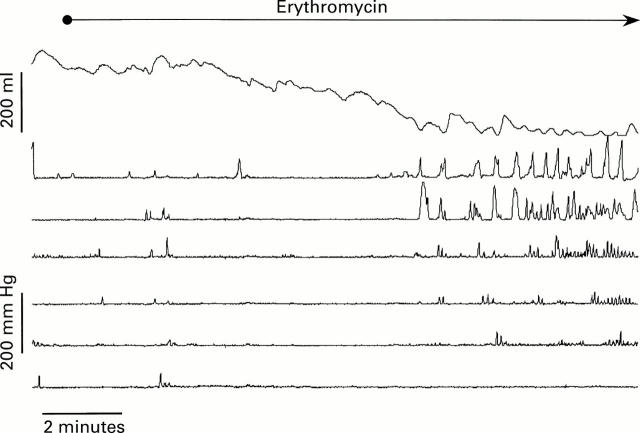 Figure 3  