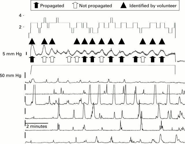 Figure 5  