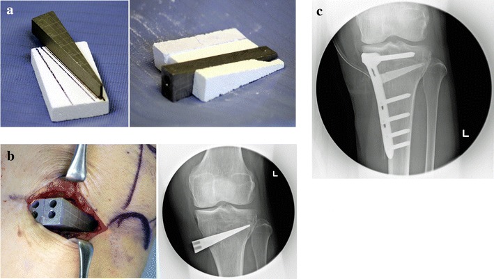 Fig. 1