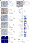 Figure 3. SY-1365 inhibits proliferation and CDK7 targets in a PDX model. IHC staining (A) and quantification (% of positive cells; B) of Ki67. IHC for p-ER (S118; C) total ER (E), and their quantification (H-score; D and F, respectively). G, ESR1 gene expression, reported as normalized gene counts, in the four treatment conditions (N > 2). IHC staining and quantification of p-CDK1 (T161; % of positive cells; H), p-CDK2 (T160; % of positive cells; I), and c-Myc (H-score; J). K, TUNEL (green) and DAPI (blue) staining and quantification (% of positive cells). Scale bar: 50 μm. Statistic one-way ANOVA Tukey multiple comparisons test. L, GSEA on differentially expressed genes comparing fulvestrant-treated, SY-1365–treated, and fulvestrant + SY-1365–treated versus untreated PDX tumors. Only the Hallmark pathways that were significantly enriched (FDR < 0.25, GSEA weighted Kolmogorov–Smirnov test) in at least one condition are shown. M, Proposed model of the effects of CDK7 inhibition on ER.