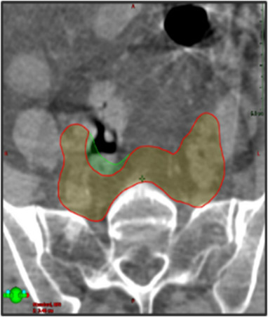 FIGURE 3