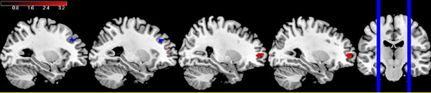 Fig 4
