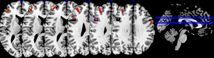 Fig 3