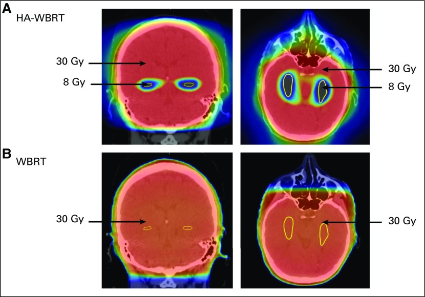 FIG 1.