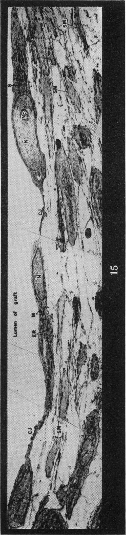 Fig. 15