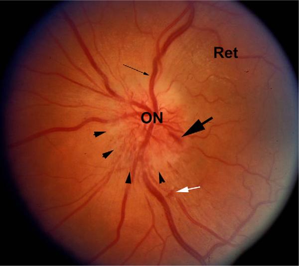 Fig. 1