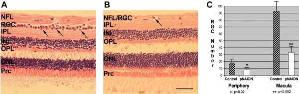 Fig. 21