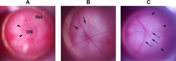 Fig. 15