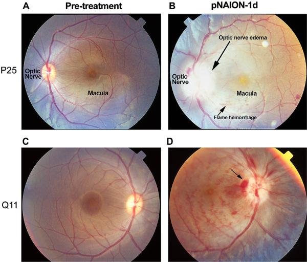 Fig. 18