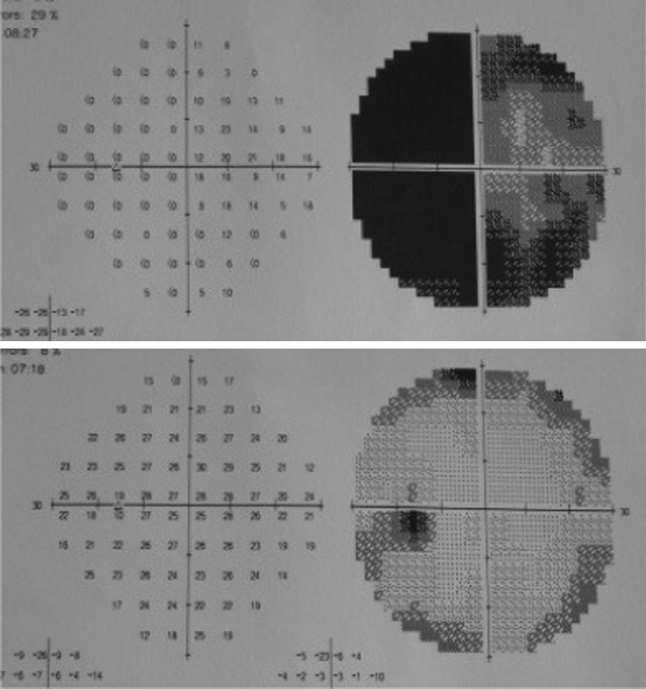 Fig. 3