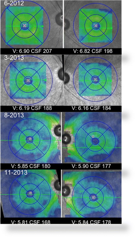 Fig. 3