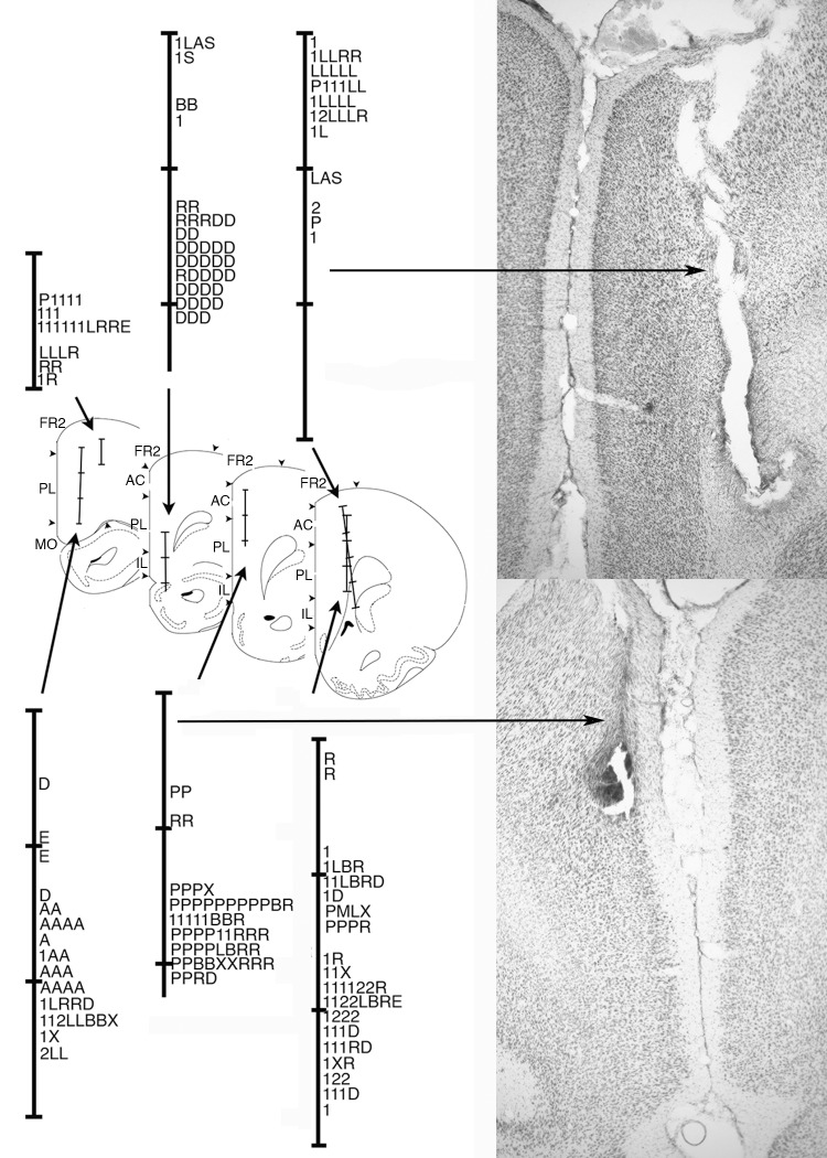 Fig 10