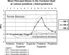 Figure 7. Stress contour plots showing maximum and minimum principal stresses (MPa) on the condylar head at HA1, HA2, and HA3.