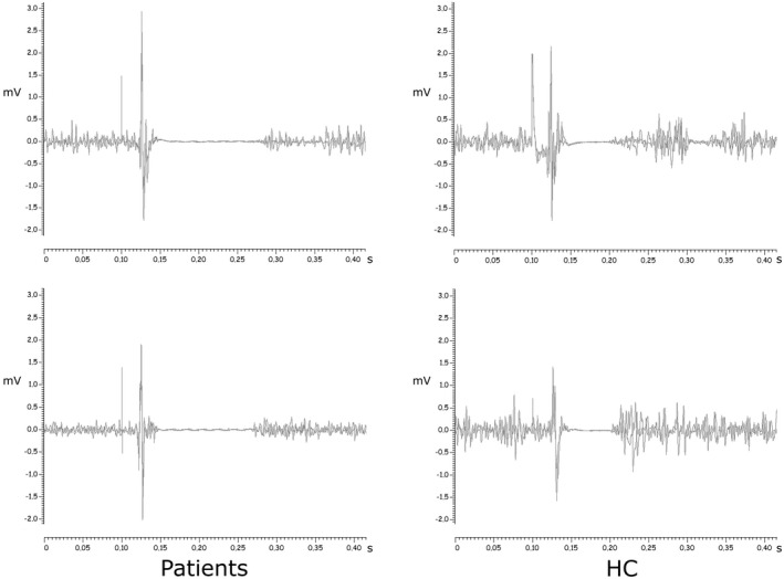 FIGURE 2