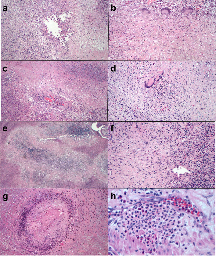 Fig. 4