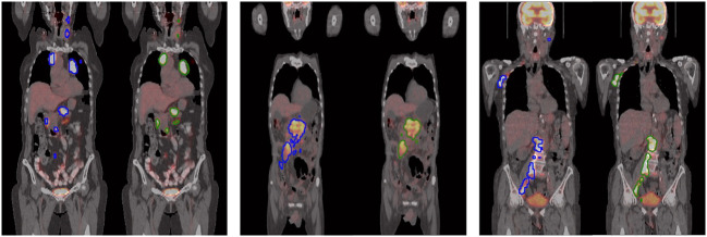 Fig. 3