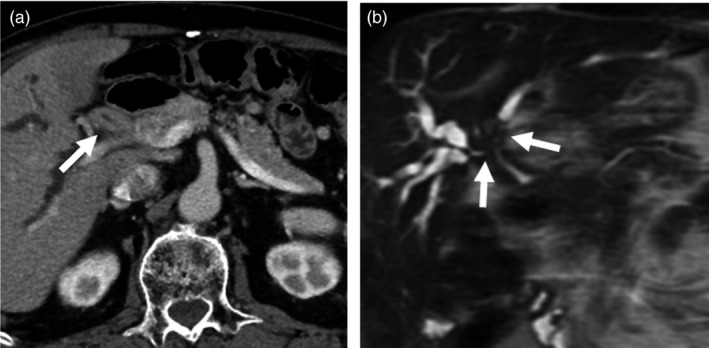 Figure 15