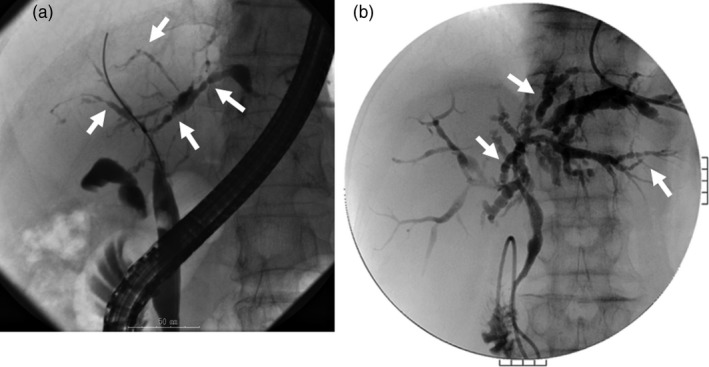 Figure 21